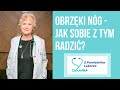 Q & A. Obrzęki nóg.