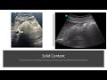 gastric ultrasound