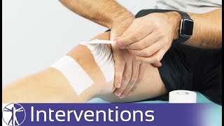 McConnell Taping for PFPS | Patellofemoral Pain Syndrome
