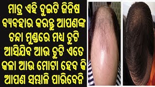 ଦୁଇଟି ଜିନିଷକୁ ବ୍ୟବହାର କରି ଆପଣଙ୍କ ଚନ୍ଦା ମୁଣ୍ଡରେ ମଧ୍ୟ ଚୁଟି ଆସିଯିବ ଚୁଟି ଏତେ କଳା ହେବ କି ସମ୍ଭାଳି ପାରିବେନି