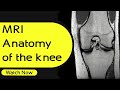 MRI Anatomy of the knee