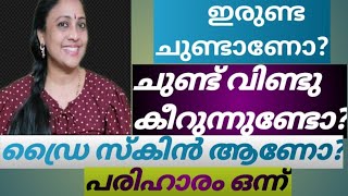 ചുണ്ട് വിണ്ടുകീറുന്നുണ്ടോ? ഇരുണ്ട ചുണ്ടാണോ? ഡ്രൈ സ്കിൻ ആണോ? പരിഹാരം ഒന്ന് 👍Nayan's Dreams \u0026 Craft