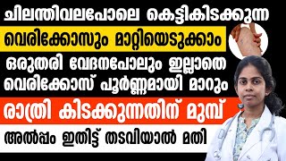 ഒരുതരി വേദനപോലും ഇല്ലാതെ വെരികോസ് പൂർണ്ണമായി മാറ്റാൻ രാത്രി കിടക്കുന്നതിനു മുൻപ് ഇങ്ങനെ ചെയ്‌താൽ മതി