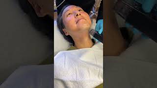 Watch Me Undergo A Morpheus8 Treatment! #morpheus8 #morpheus @InModeSolutions