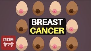 How To Recognise 12 Symptoms of Breast Cancer : BBC Duniya