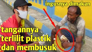 ODGJ INI TANGANNYA MEMBUSUK DAN HAMPIR PUTUS | INGUSPUN DI MAKAN | PART I