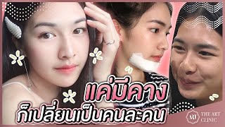 VLOG เสริมคาง : สาวคางสั้นหน้ากลม อยากหน้าสวยต้องดู :The Art Clinic