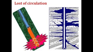 4. lost of circulation problem