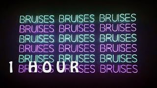 [1 HOUR 🕐 ] IZKO, MOLOW - Bruises (Lyrics) ft Jay Mason