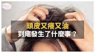 【頭髮救星】洗髮乳用不對，頭皮就容易出油、容易癢？頭皮沒養好，可能會導致禿頭？最簡單的保養頭皮方式大公開！｜健康直播精華｜賴宇凡Sara