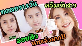 ผิวหน้ากระจ่างใส รอยสิวหายใน14วัน ด้วยครีมเจ้าสาว Shine Bride