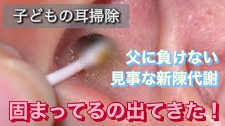 子どもの耳掃除　小学生の新陳代謝でしっかり耳の中に溜め込んでいました。00:57〜02:00〜 03:46〜 05:35〜　06:14〜