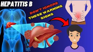 Identify Warning Signs of Hepatitis B | Signs and Symptoms of Hepatitis B