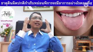 MP123: ธาตุดินผิดปกติจะแสดงอาการเจ็บป่วยออกมาอย่างไรบ้างตอนที่ ๔