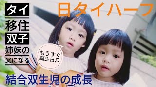 [結合双生児]日タイハーフ双子姉妹 ふたりの成長[海外移住]