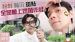 粉刺、暗沉、粗糙 原來是臉上壞菌作怪！ll Kevin想得美 ll Skin Care Review