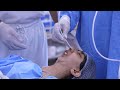 Difficult Anesthesia Intubation  for a Girl