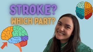 Stroke Location Changes Everything: Here’s Why