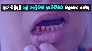 දත් මදිද්දි ලේ ගැලීමක් ඇතිවීමට බලපාන හේතු