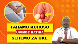 UVIMBE KATIKA SEHEMU ZA UKE (BARTHOLIN CYST)- DR. Benny Ft Dr. Issa Mbashu