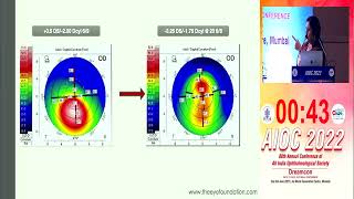 AIOC2022 GP99 topic Dr  CHITRA RAMAMURTHY Topo Guided Treatment for Irregular Cornea