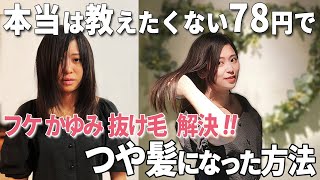 【本当は教えたくない】コスパ最強のヘアケア3選。フケ！かゆみ！抜け毛の悩みも解決しました。