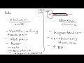 renal artery stenosis