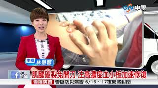 中視新聞肌腱破裂免開刀 注高濃度血小板加速修復20150611