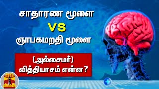 சாதாரண மூளை VS ஞாபகமறதி மூளை (அல்சைமர்) வித்தியாசம் என்ன? | Alzheimer | Brain