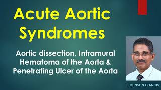 Acute Aortic Syndromes