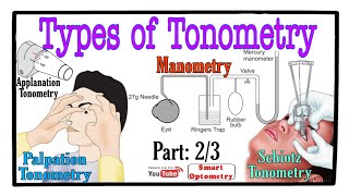 Tonometry -All Types of Tonometry 2/3