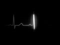 heart flatline