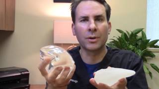 “Gummy Bear” Implants vs. Regular Implants | Dr. Birchenough