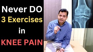 Never Do 3 Exercises in Knee Pain, Knee osteoarthritis, Patellofemoral Syndrome, Knee Pain Treatment