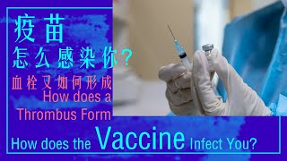 疫苗怎么感染你？How does the Vaccine Infect You?