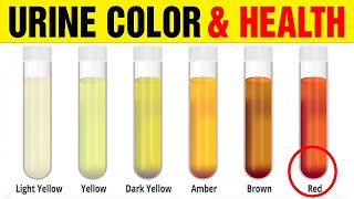 WATCH NOW! What The Color Of Your Urine Says About Your Health