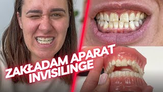 Zakładam Aparat Na Zęby - INVISALIGN | Chodźmy Na Zakupy  | jedz pysznie