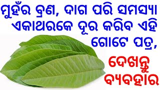 ପୁଅ ହୁଅନ୍ତୁ ବା ଝିଅ ନିଜ ମୁହଁରୁ ସବୁ ବ୍ରଣ, ଦାଗ ଗୋଟିଏ ଥରକରେ ସଫା କରିବ ଏହି ପତ୍ର, ଦେଖନ୍ତୁ ଏହାର ବ୍ୟବହାର