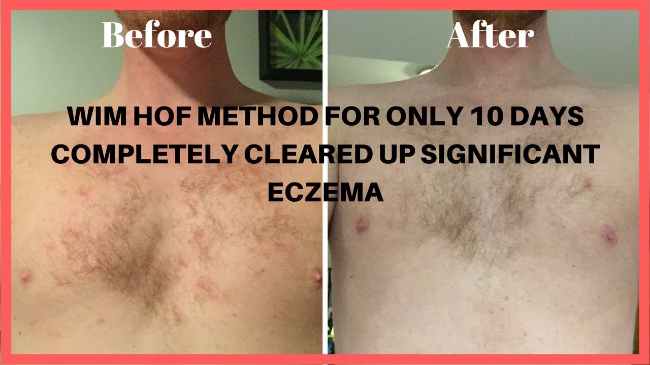 Wim Hof Method Results Adviserlockq