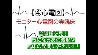 ④心電図～モニター心電図の実臨床(気になるあの波形を循環器が解説します)