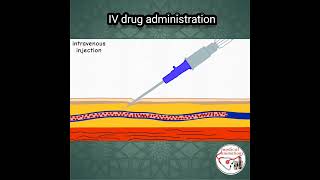 💉 IV DRUG ADMINISTRATION PROCEDURE | ANIMATED EXPLANATION | #shorts #medicine #nurse
