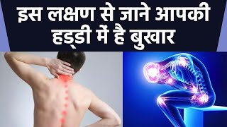 हड्डी का बुखार के लक्षण और दूर करने के उपाय । Bone Fever Symptoms । Boldsky