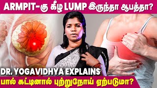 மாதவிடாய் வர மாத்திரை எடுத்தால் Breast Cancer வருமா? - Dr. Yogavidhya | Ethnic Health Care