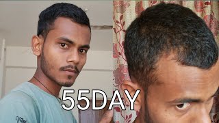 55DAY hairgrauth risult from Diksha Ayurveda bhavan Lakhanu l