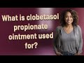 What is clobetasol propionate ointment used for?