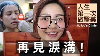 再見黑眼圈～我去打淚溝啦 人生第一次醫美 ft. Idos Clinic | Lydia Share