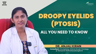 Droopy Eyelids (Ptosis): Explained | Dr Anjali Kiran | English