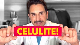 4 PRINCIPAIS CAUSAS DA CELULITE 🚨 Dr. Samuel Colman