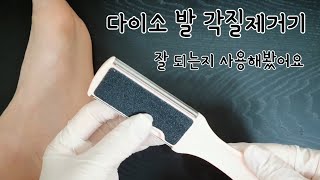 다이소 발 각질제거기 / 각질제거 잘 되는지 사용해봤어요!(더러움 주의)