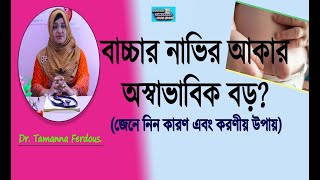 বাচ্চাদের নাভির হার্নিয়া হওয়ার কারণ/ Causes \u0026 treatment of umbilical hernia.